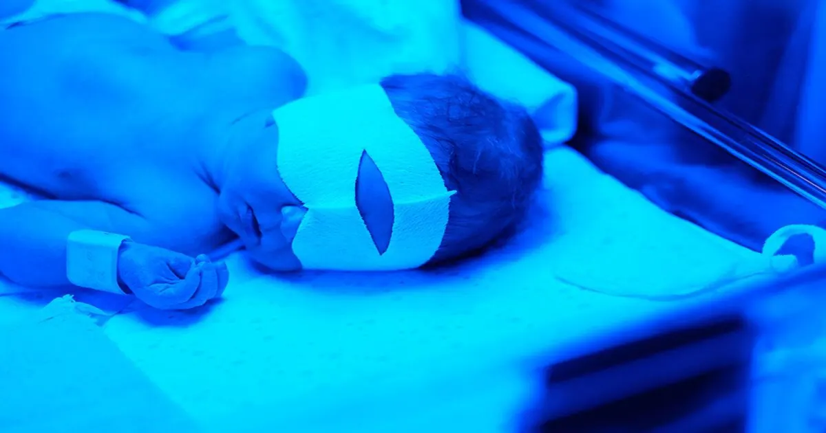 Geelzucht bij je baby: wat is normaal en wanneer bel je?